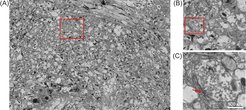 Figure 1: (A) Montage of 1080 TEM images showing the entire mushroom body calyx region from the Drosophila brain. (B) Zoom into the region marked in (a). Several bouton regions are visible, one of which showing a synaptic active zone is highlighted in (C).