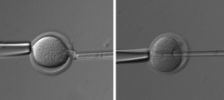 Removal of the metaphase spindle and nuclear transfer of a somatic cell into the enucleated oocyte.