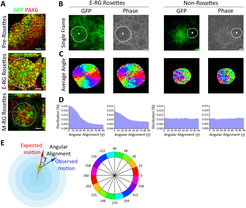 Devising a quantitative live imaging approach to measure neural stem cell nuclear migration dynamics during cortical differentiation from human pluripotent stem cells. From Ziv, Zaritsky, Yaffe et al., PLoS Computational Biology 2015.