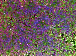 Neural rosettes