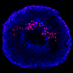 Cavitation of a human induced pluripotent stem cell based organoid