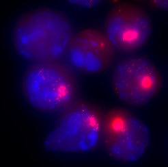 Nuclei of female cells. The RNA molecules responsible for inactivating the second X chromosome are labeled with a red dye.