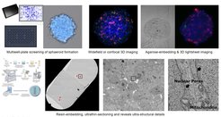 Figure 2: HEK cell spheroids are used as a test case for developing correlative workflows. Fluorescence light microscopy techniques are used to screen and identify suitable targets (upper panel), which are then imaged successively by electron microscopy to reveal ultrastructural details (lower panel).