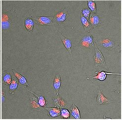 How do chromophobe renal cell carcinoma (chRCC) cells get nutrients despite poorly developed blood vessels within the tumor? To address this question, we used fluorescent-labeled bovine serum albumin (BSA) to track the uptake of a macro-molecule, a process called macropinocytosis. Compared to healthy kidney cells, chRCC cells showed significant enrichment of macropinocytosis, indicating that this kidney cancer can adapt to nutrient poor conditions. This image features chRCC cells, in blue: nuclei, in red: fluorescent-labeled BSA within chRCC cells.