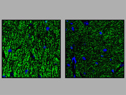 Hippocampus: In the transgenic mice (Pigv341E; right) there are fewer vesicles (green) in which neurotransmitters are stored than in the control animals (left). This could be responsible for the synaptic defect.