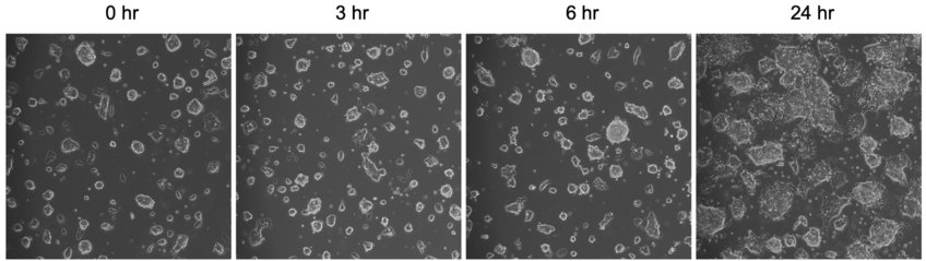 Early events in pluripotency exit