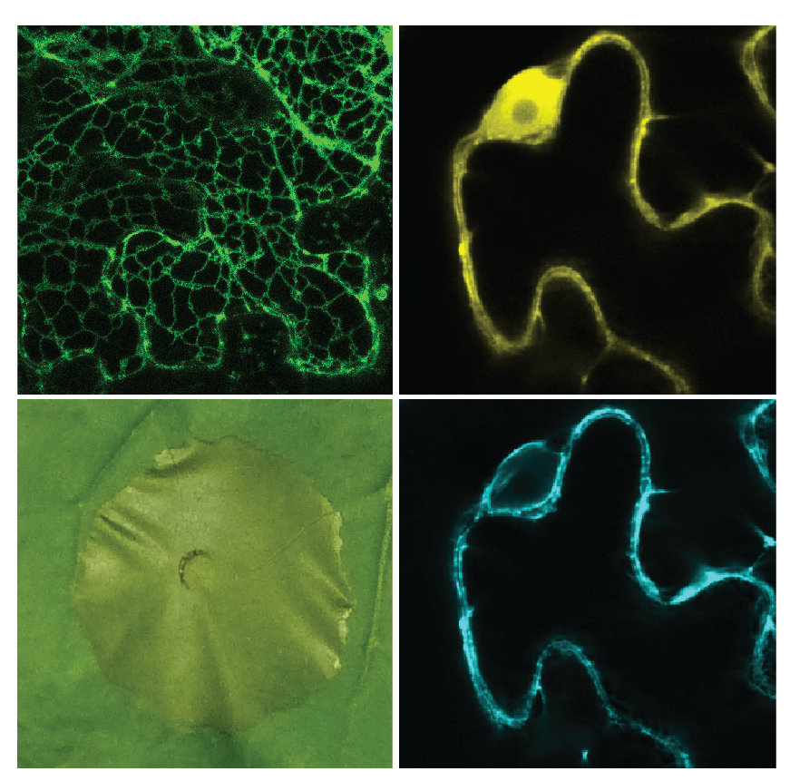 NLR immune receptor signaling and cell death execution in plant innate immunity