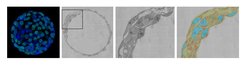(from left to right) Confocal image of a mouse blastocyste; montage of TEM images taken from a mouse blastocyste after resin embedding and ultrathin-sectioning; zoom into the highlighted region; quantitativ and statistical analysis of ultrastructural details such as nuclei (cyan). mitochondria (red) and lipd droplets (green). Project with the group of Aydan Bulut-Karslıoğlu.