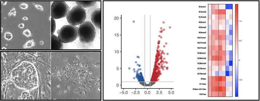 Gene-environment interactions Gene-environment interactions